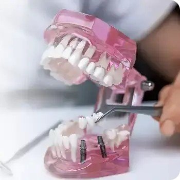 Restorative-Dentistry